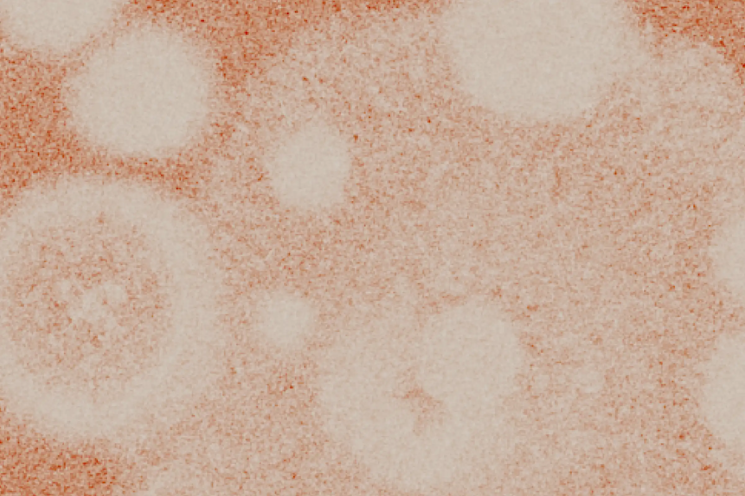 Ureaplasma: Symptoms and Treatment Options | Evvy